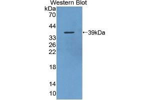 Western Blotting (WB) image for anti-Small Breast Epithelial Mucin (SBEM) (AA 21-90) antibody (ABIN1870572)
