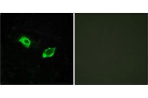 Immunofluorescence analysis of HuvEc cells, using GPR158 Antibody. (GPR158 anticorps  (AA 1-50))