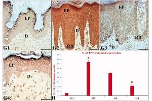 The effects of ustekinumab and the CUC on the immunoexpression (IE) of TNF-α in IQ-induced psoriatic skin lesions. (TNF alpha anticorps)