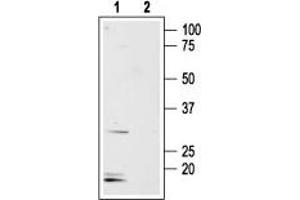 Western blot analysis of rat small intestine membranes: - 1.