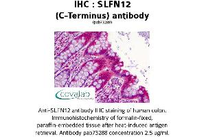Image no. 2 for anti-Schlafen Family Member 12 (SLFN12) (C-Term) antibody (ABIN1739425) (SLFN12 anticorps  (C-Term))