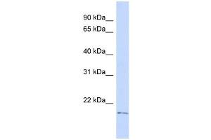 WB Suggested Anti-TGIF2LY Antibody Titration:  0. (TGIF2LY anticorps  (Middle Region))