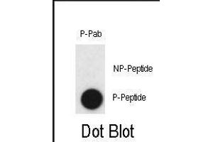 Dot blot analysis of anti-Phospho-CLDN2-p Antibody (ABIN390022 and ABIN2839781) on nitrocellulose membrane. (Claudin 2 anticorps  (pTyr224))
