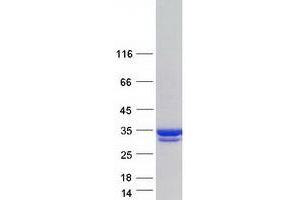 Validation with Western Blot