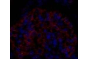 Immunofluorescence analysis of Rat kidney tissue using EIF2 alpha Polyclonal Antibody at dilution of 1:200.