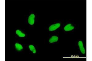 Immunofluorescence of purified MaxPab antibody to DR1 on HeLa cell.