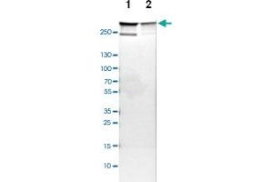 Western blot analysis of Lane 1: NIH-3T3 cell lysate (Mouse embryonic fibroblast cells), Lane 2: NBT-II cell lysate (Rat Wistar bladder tumour cells) with FLNA polyclonal antibody  at 1:100-1:500 dilution.