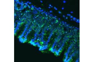 IF analysis of Claudin18/CLDN18 using anti-Claudin18/CLDN18 antibody (ABIN7601257). (Claudin 18 anticorps  (AA 31-261))