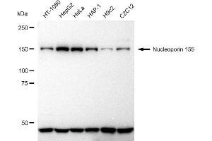 anti-Nucleoporin 155kDa (NUP155) antibody