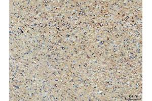 IHC analysis of PPP2CA using anti-PPP2CA antibody (ABIN3043356). (PPP2CA anticorps  (AA 1-309))