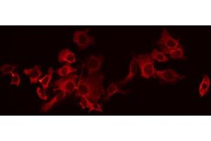ABIN6266542 staining HeLa by IF/ICC. (GABBR1 anticorps  (C-Term))