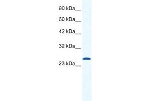 WB Suggested Anti-CACNG6 Antibody Titration:  1. (CACNG6 anticorps  (N-Term))