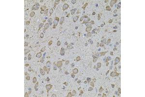 Immunohistochemistry of paraffin-embedded mouse brain using COL1A2 antibody.