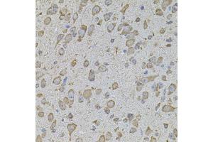 Immunohistochemistry of paraffin-embedded mouse brain using COL1A2 antibody. (COL1A2 anticorps)