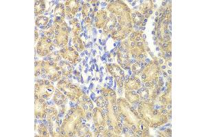 Immunohistochemistry of paraffin-embedded rat kidney using HSPA9 antibody at dilution of 1:200 (400x lens).