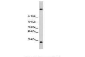 Image no. 3 for anti-Deleted In Azoospermia 4 (DAZ4) (N-Term) antibody (ABIN6736264)