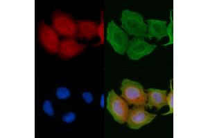 ABIN6256923 and ABIN6274414 staining Hela cells(45 min of heat-shock) by IF/ICC. (ADCK1 anticorps  (Internal Region))