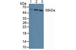 Western blot analysis of (1) Human HepG2 Cells, (2) Human Jurkat Cells and (3) Human HeLa cells. (DKC1 anticorps  (AA 298-465))