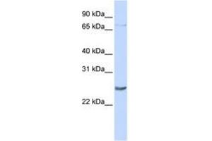 Image no. 1 for anti-PR Domain Containing 5 (PRDM5) (C-Term) antibody (ABIN6742850)