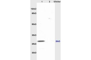 Lane 1: mouse heart lysates Lane 2: mouse lung lysates probed with Anti AQP1/CHIP Polyclonal Antibody, Unconjugated (ABIN687502) at 1:200 in 4 °C.