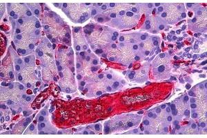 Rat Pancreas, Vessel: Formalin-Fixed, Paraffin-Embedded (FFPE) (RECA-1 anticorps)