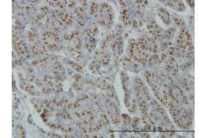 Image no. 1 for anti-Mannosyl (Alpha-1,3-)-Glycoprotein beta-1,4-N-Acetylglucosaminyltransferase, Isozyme A (MGAT4A) (AA 436-536) antibody (ABIN599178) (MGAT4A anticorps  (AA 436-536))