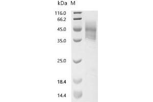Advanced Glycosylation End Product-Specific Receptor (AGER) (AA 23-341) protein (His tag)