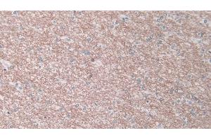 Detection of ELA1 in Human Cerebrum Tissue using Polyclonal Antibody to Pancreatic Elastase 1 (ELA1)