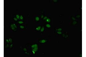 Immunofluorescent analysis of HepG2 cells using ABIN7145824 at dilution of 1:100 and Alexa Fluor 488-congugated AffiniPure Goat Anti-Rabbit IgG(H+L)
