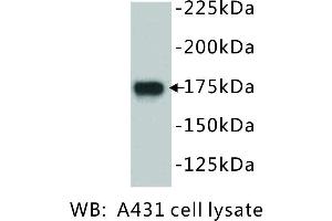 Image no. 1 for anti-Epidermal Growth Factor Receptor (EGFR) antibody (ABIN1112884) (EGFR anticorps)