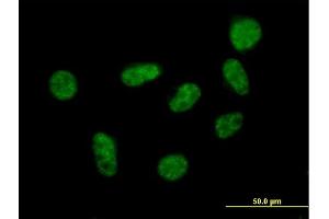 Immunofluorescence of purified MaxPab antibody to SART1 on HeLa cell. (SART1 anticorps  (AA 1-800))