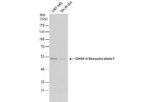 WB Image GABA A Receptor alpha 1 antibody detects GABA A Receptor alpha 1 protein by western blot analysis.