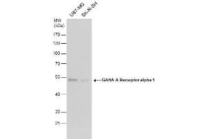 WB Image GABA A Receptor alpha 1 antibody detects GABA A Receptor alpha 1 protein by western blot analysis. (GABRA1 anticorps  (Center))