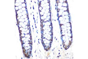 Immunohistochemistry of paraffin-embedded human colon using J/CSN5/COPS5 Rabbit mAb (ABIN7266497) at dilution of 1:100 (40x lens).