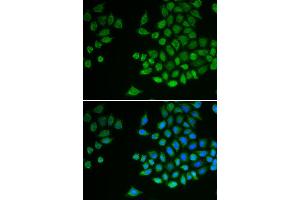 Immunofluorescence analysis of MCF-7 cell using PTPN2 antibody. (PTPN2 anticorps)