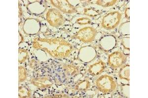 Immunohistochemistry of paraffin-embedded human kidney tissue using ABIN7142377 at dilution of 1:100 (MRPL21 anticorps  (AA 40-205))
