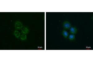 ICC/IF Image ROCK2 antibody detects ROCK2 protein at cytoplasm by immunofluorescent analysis. (ROCK2 anticorps)
