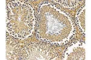 ABIN7096233 and ABIN7100295 at 1/100 staining rat testis tissue by IHC-P. (PCMTD1 anticorps)