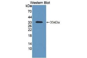 Western blot analysis of the recombinant protein. (KERA anticorps  (AA 21-292))