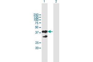 Western Blot analysis of EPCAM expression in transfected 293T cell line by EPCAM MaxPab polyclonal antibody.