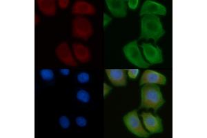 ABIN6258093 and ABIN6275148 staining Hela cells by IF/ICC. (GJC1 anticorps  (C-Term))