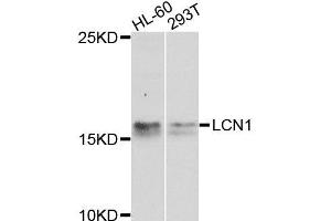 Western blot analysis of extracts of various cell lines, using LCN1 antibody (ABIN6003560) at 1/1000 dilution. (Lipocalin 1 anticorps)