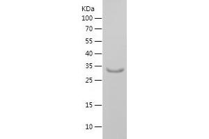 Western Blotting (WB) image for Potassium Voltage-Gated Channel, Shaker-Related Subfamily, beta Member 2 (KCNAB2) (AA 122-210) protein (His-IF2DI Tag) (ABIN7124534)