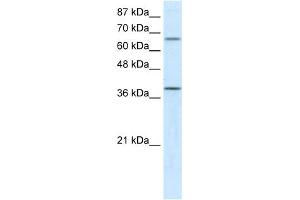 WB Suggested Anti-ACADM Antibody Titration:  5. (Medium-Chain Specific Acyl-CoA Dehydrogenase, Mitochondrial (N-Term) anticorps)