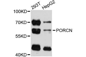 Western blot analysis of extracts of various cell lines, using PORCN antibody (ABIN5998572) at 1:3000 dilution. (PORCN anticorps)