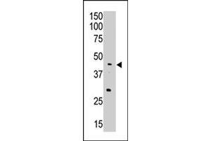 The APOBEC3G polyclonal antibody  is used in Western blot to detect APOBEC3G in A-549 cell lysate. (APOBEC3G anticorps  (Internal Region))