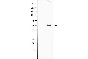 Western blot analysis of Keratin 8 expression in EGF treated 293 whole cell lysates,The lane on the left is treated with the antigen-specific peptide.