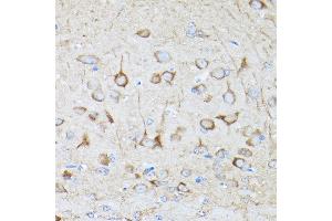 Immunohistochemistry of paraffin-embedded rat brain using DRP1 Rabbit pAb (ABIN3023669, ABIN3023670, ABIN3023671, ABIN1679564 and ABIN6219696) at dilution of 1:250 (40x lens).