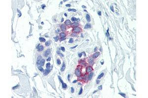 Anti-Prolactin Receptor antibody IHC of human breast. (Prolactin Receptor anticorps)