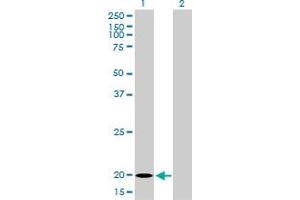 Western Blot analysis of FTL expression in transfected 293T cell line by FTL monoclonal antibody (M16), clone X1.